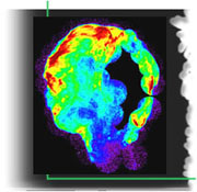 X-ray Image of Supernova Remnant 